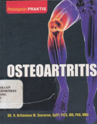 Image of Osteoartritis