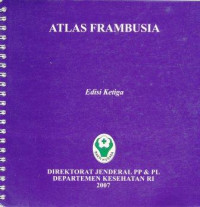 Image of Atlas frambusia