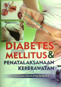 Image of Diabetes melitus dan penatalaksanaan keperawatan