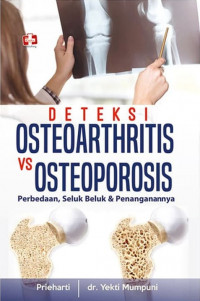 Deteksi osteoarthritis vs osteoporosis : perbedaan, seluk beluk & penanganannya