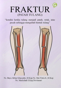 Image of Fraktur (patah tulang)