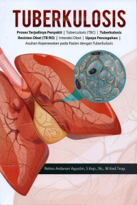 Image of Tuberkulosis