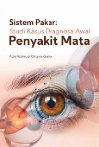 Sistem pakar : studi kasus diagnosa awal penyakit mata